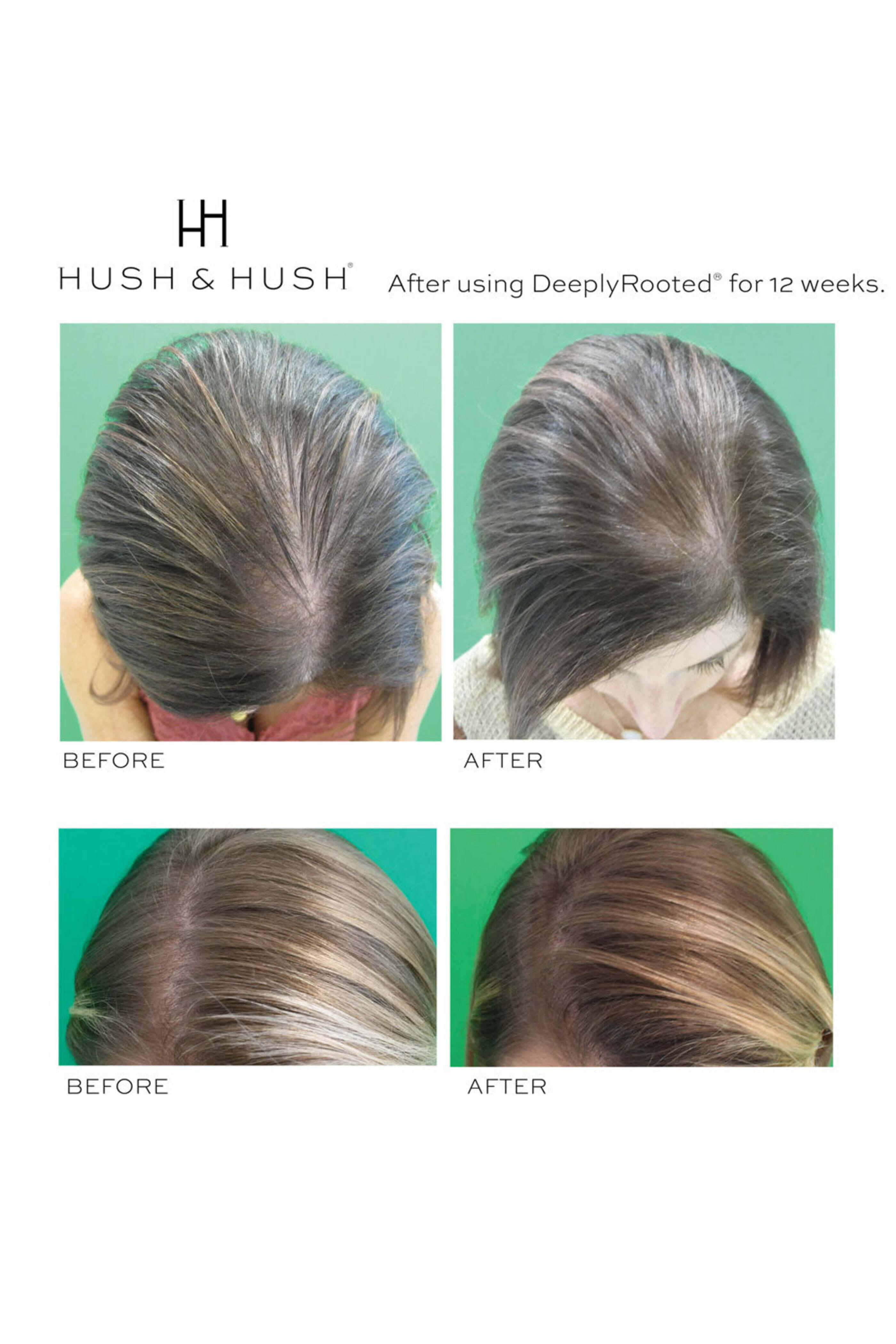 Hush & Hush - Deeply Rooted Hair Health Supplement